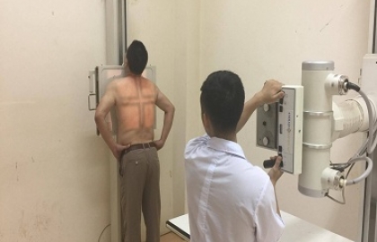 Vi phẫu tai mũi họng